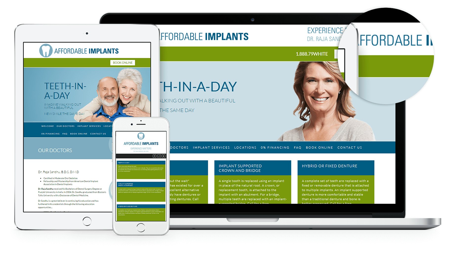 New Website for Affordable Implants Launched! Affordable Implants website was developed to provide patients with information on where to go in order